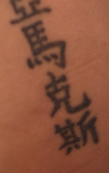 Rimozione tatuaggio con laser