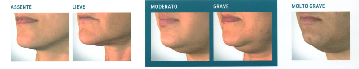 profilo mento