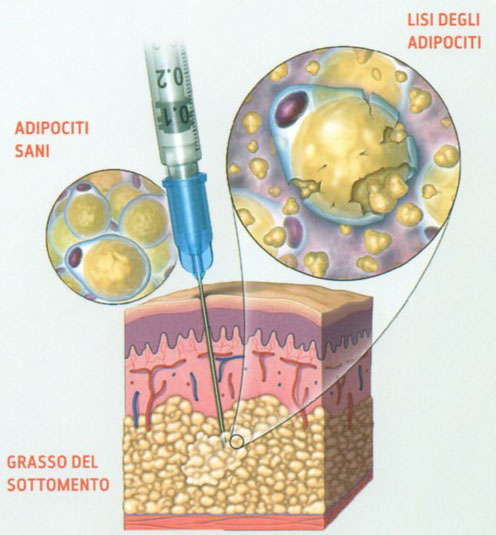 effetti collaterali del trattamento
